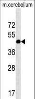 RCD1 / RQCD1 Antibody (aa106-134)