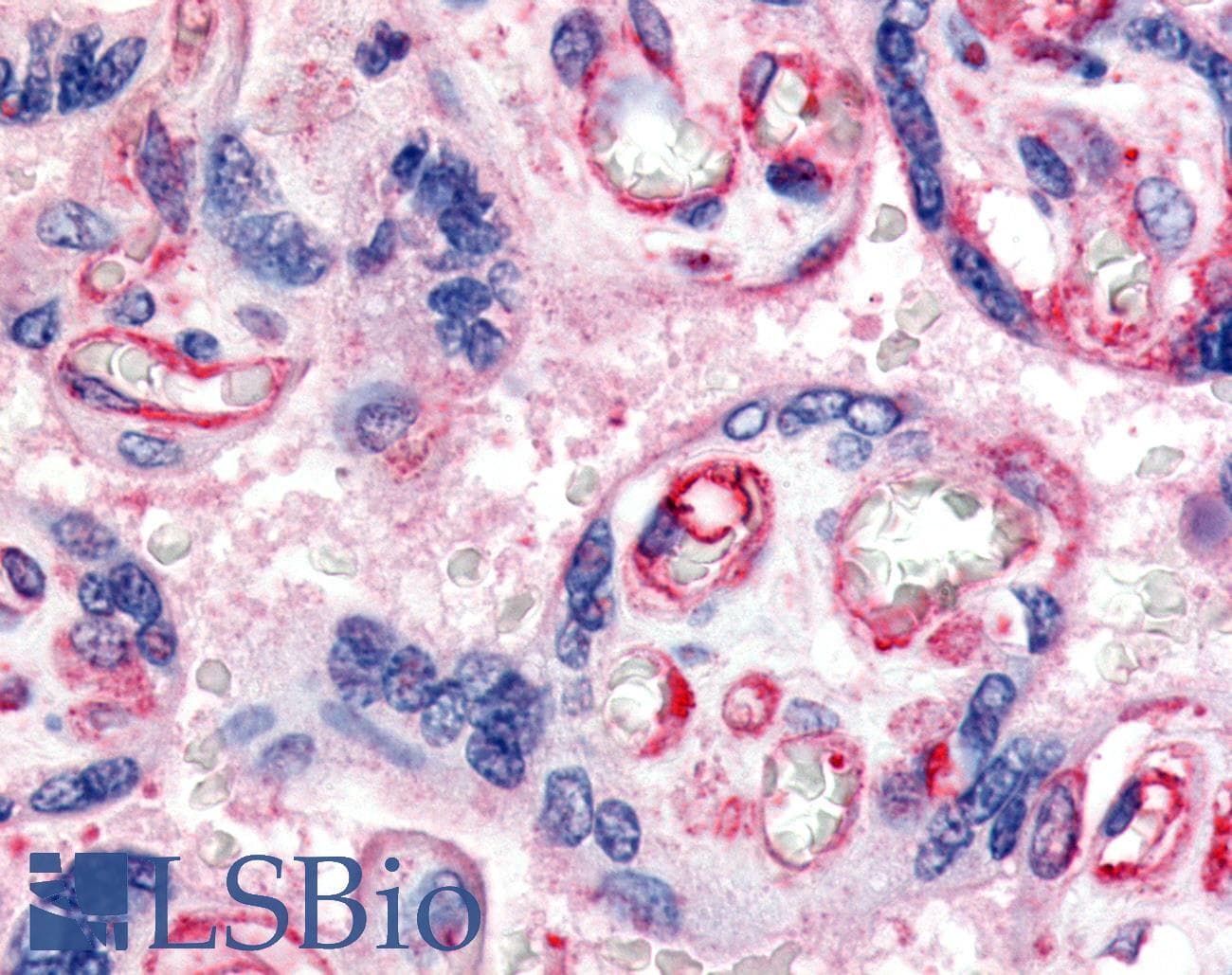 IHC-plus™ FLT1 / VEGFR1 Antibody (C-Terminus)