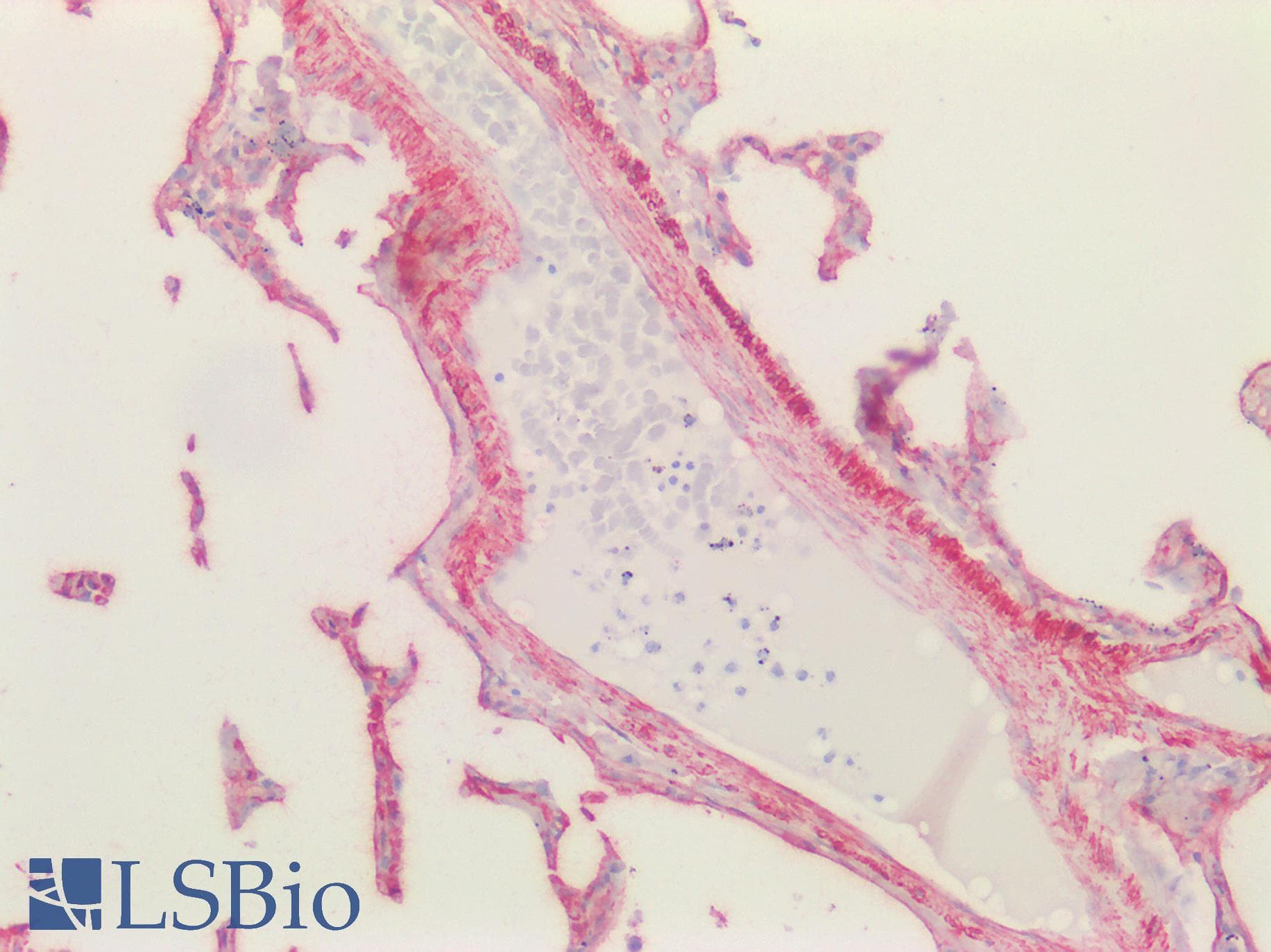 PathPlus™ Polyclonal Goat anti-Human CAV1 / Caveolin 1 Antibody (aa73-84, IHC, IF, WB)