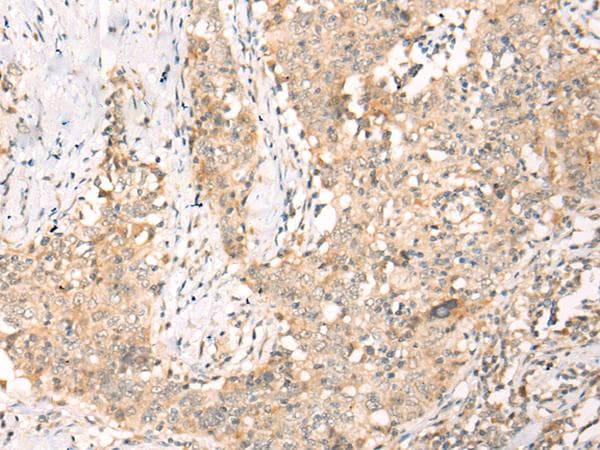 YRDC Antibody