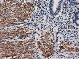 DES / Desmin Antibody (aa104-391, clone 4G1, Carrier-free)