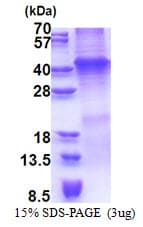Human WNT7A Protein (Recombinant His)