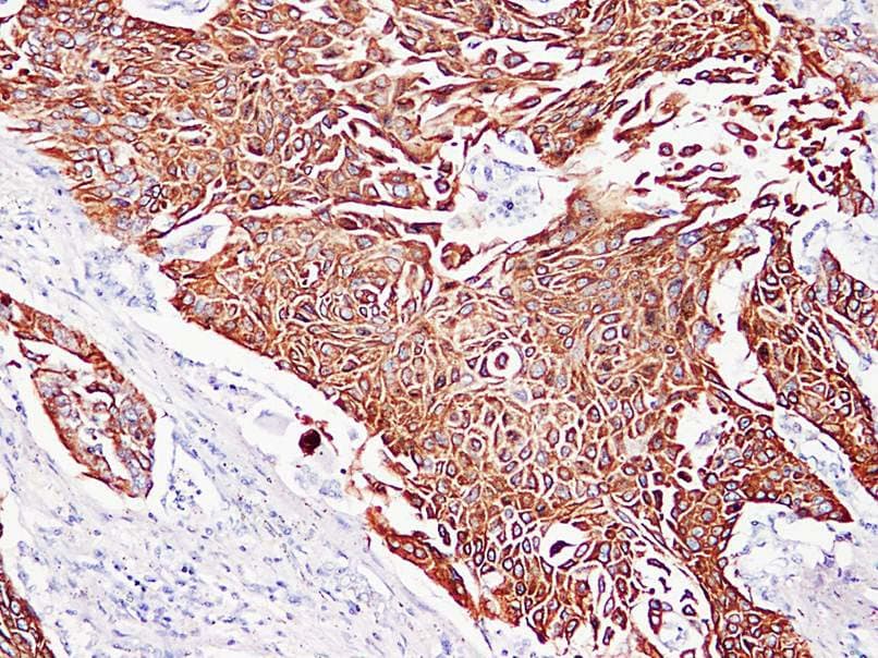 IHC-plus™ Cytokeratin 5+6 Antibody (clone ABT-CK5/6)