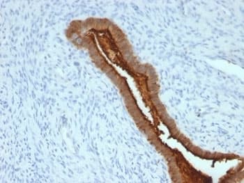 EMA / MUC1 Antibody (clone SPM492)