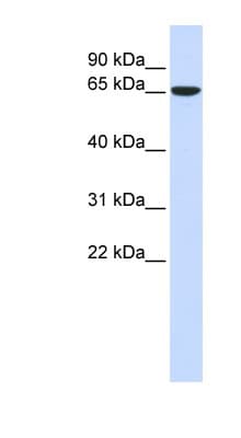 Polyclonal Rabbit anti-Human CKAP4 Antibody (C-Terminus, IHC, WB)