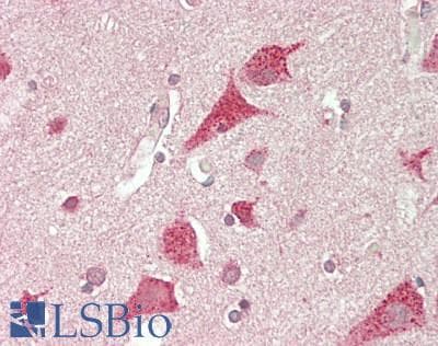 IHC-plus™ GALNS / Chondroitinase Antibody (aa236-263)