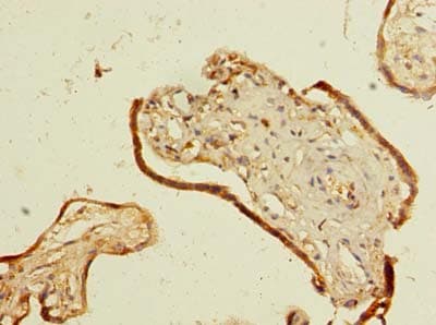 SMIM14 / C4orf34 Antibody