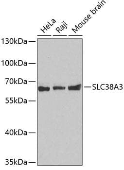 SLC38A3 / SNAT3 Antibody