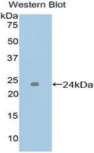ICAM4 / CD242 Antibody (aa52-234, Cy3)