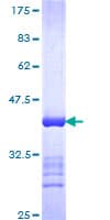 Human N4BP2 Protein (Recombinant GST, N-terminus)