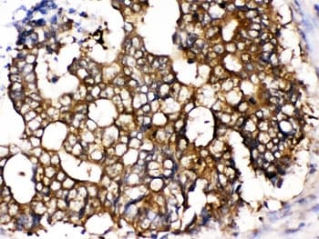 CCT5 / TCP1 Epsilon Antibody