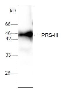 Monoclonal Mouse anti-Human PRPS1L1 Antibody (WB)