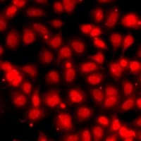 SUMO4 Antibody