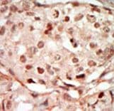 Polyclonal Rabbit anti-Human CDK10 Antibody (aa1-32, IHC, WB)