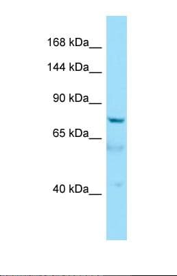 Polyclonal Rabbit anti-Human AKNA / KIAA1968 Antibody (aa550-599, WB)