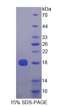 Human ISG15 Protein (Recombinant His-T7)