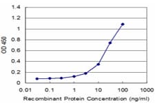 P2RY1 / P2Y1 Antibody (clone 4C2)