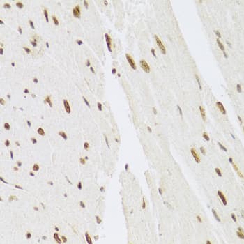 Polyclonal Rabbit anti-Human MAPK3 / ERK1 Antibody (IHC, IF, WB)