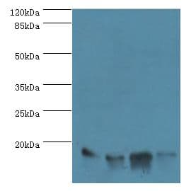 IHC-plus™ LGALS1 / Galectin 1 Antibody (aa2-135)