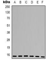 PPIA / Cyclophilin A Antibody (Internal)