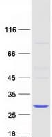 Human COMMD2 Protein (Recombinant Myc-DDK (Flag))