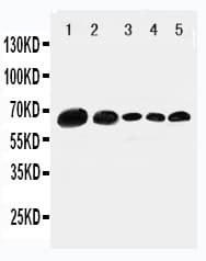 Polyclonal Rabbit anti-Human PXN / Paxillin Antibody (aa456-472, IHC, WB)