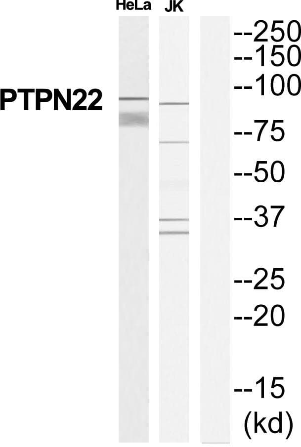 Polyclonal Rabbit anti-Human PTPN22 / PEP Antibody (WB)