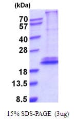 Human IL28B Protein (Recombinant His)
