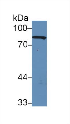 GSN / Gelsolin Antibody (aa432-780, APC)