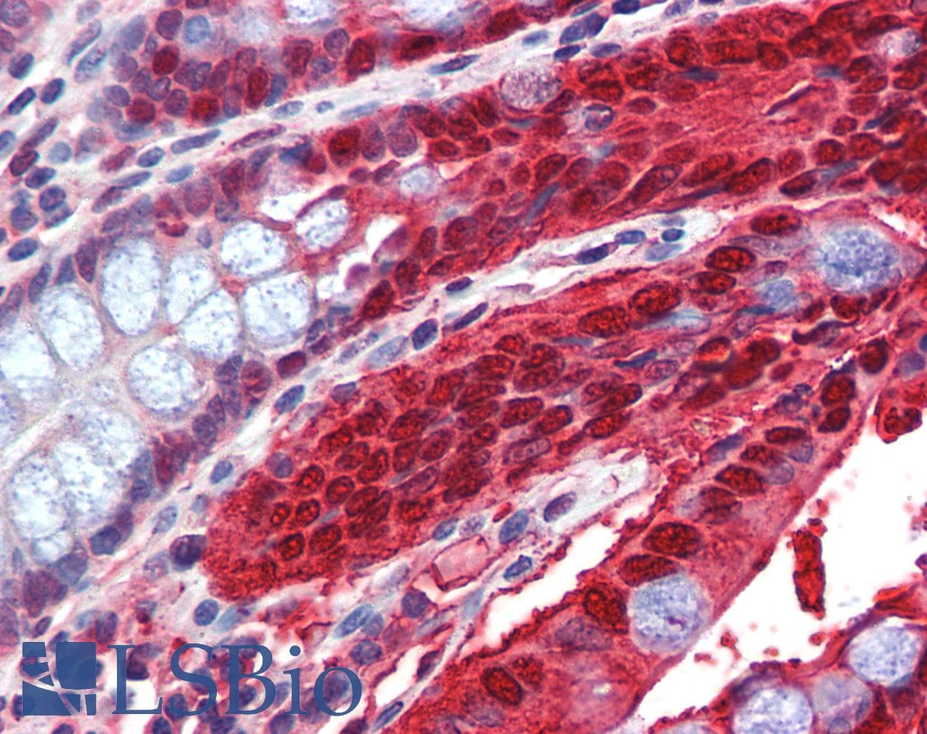 IHC-plus™ Monoclonal Mouse anti-Human CA1 / Carbonic Anhydrase I Antibody (clone 9D6D7, IHC, WB)
