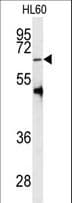 PRMT5 Antibody (aa473-499)