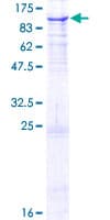 Human PNPT1 Protein (Recombinant GST)