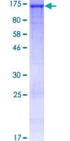 Human HAUS6 / FAM29A Protein (Recombinant GST)
