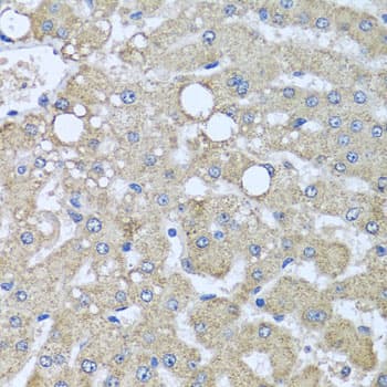 DCP2 Antibody