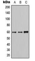 Polyclonal Rabbit anti-Human AKT1 + AKT2 + AKT3 Antibody (Internal, IHC, WB)