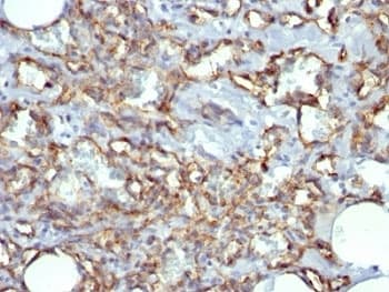 PECAM-1 / CD31 Antibody (clone JC/70A)