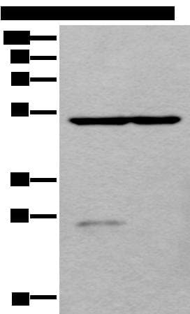 DDC / DOPA Decarboxylase Antibody