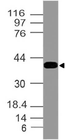 SMARCB1 / INI1 Antibody