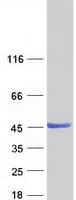 Human ZADH2 Protein (Recombinant Myc-DDK (Flag))