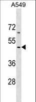 COL26A1 / EMID2 Antibody (aa261-290)
