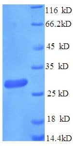Human FCGRT / FCRN Protein (Recombinant His)