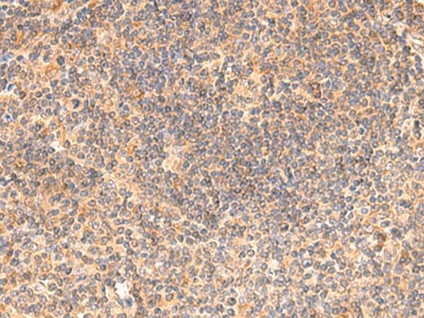 EIF3K Antibody