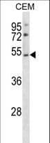 P2RY2 / P2Y2 Antibody (aa324-352)