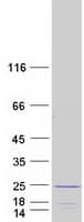 Human FLYWCH2 Protein (Recombinant Myc-DDK (Flag))