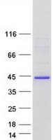 Human ODF3L2 Protein (Recombinant Myc-DDK (Flag))