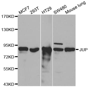 Polyclonal Rabbit anti-Human JUP/CTNNG/Junction Plakoglobin Antibody (IHC, IF, WB)
