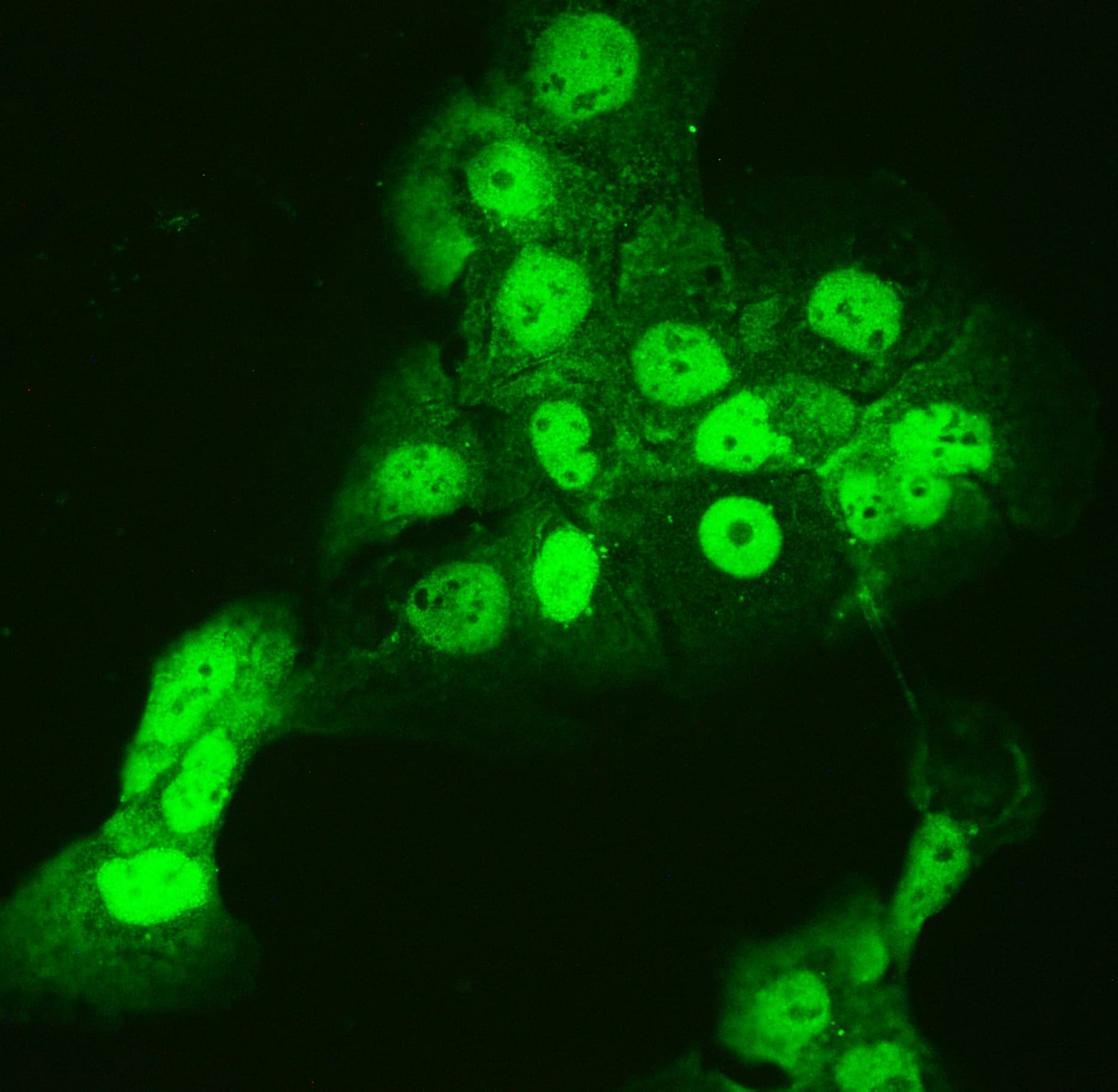 Polyclonal Rabbit anti-Human CCT3 Antibody (IHC, WB)