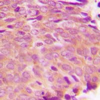 TGM2 / Transglutaminase 2 Antibody (N-Terminus)