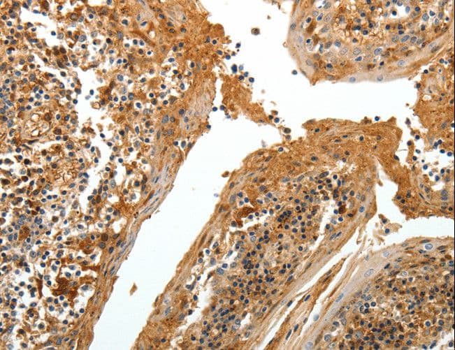 Polyclonal Rabbit anti-Human TNR / Tenascin R Antibody (IHC)