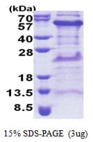 Human TIPIN Protein (Recombinant His)